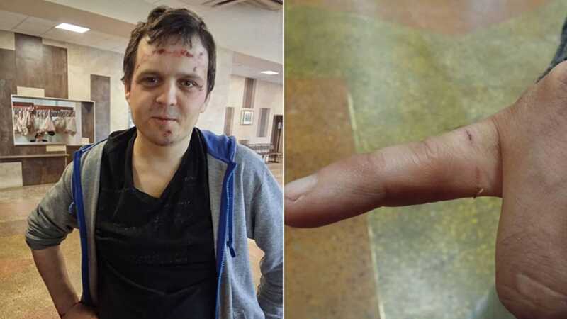 В Воронеже сотрудники силовых структур подвергли пыткам активистов из-за канала, посвященного репрессиям